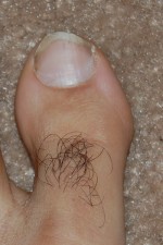 toe