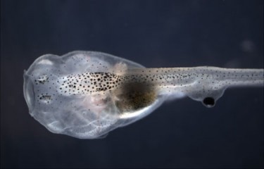 You won't believe your eye ... your eye that is in your butt.